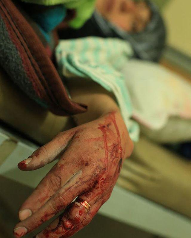 ... ما آن شقایقیم که با داغ زاده ایم!